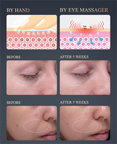 Sonic Ionic Eye Massager