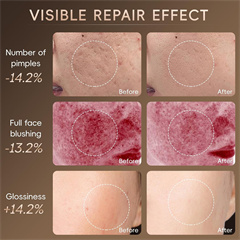 Heating Facial Cleaning Brush